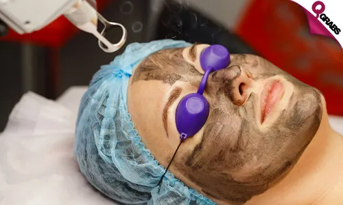 Carbon Laser Facial for Ladies & Men!